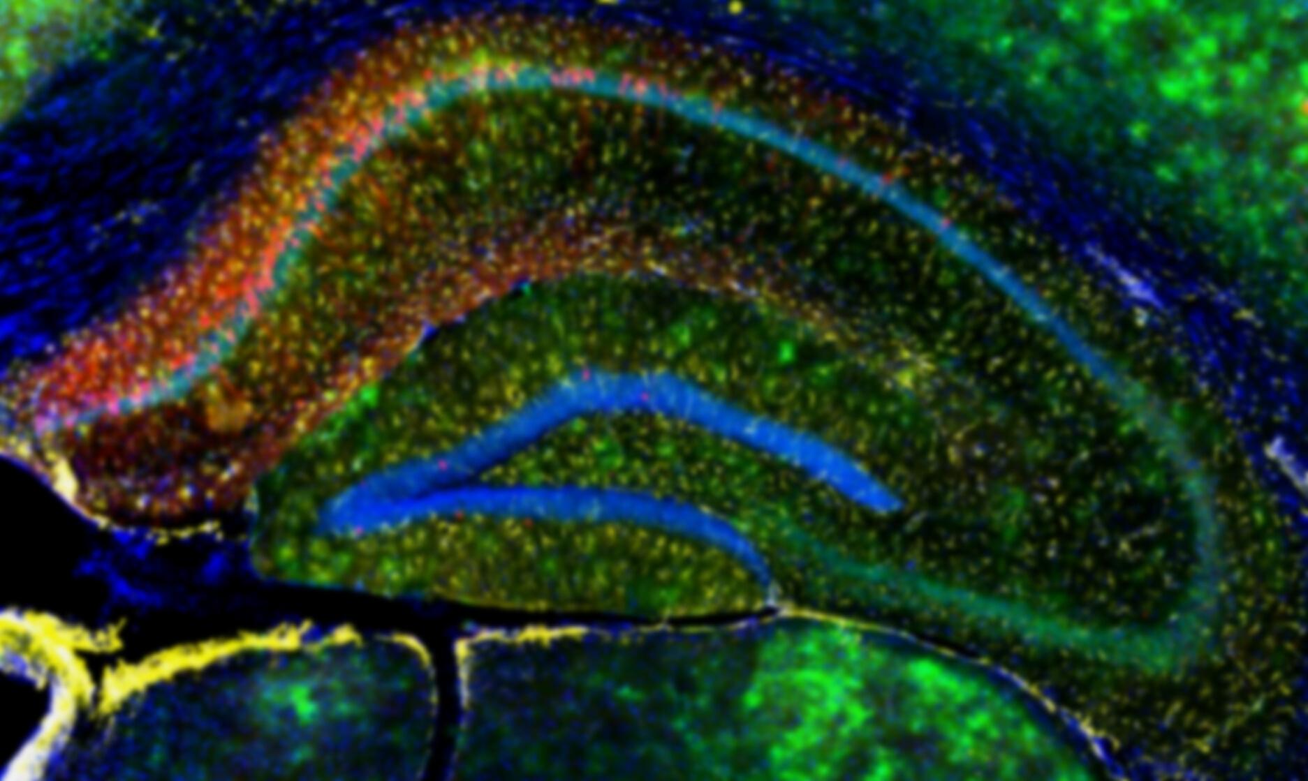 Fluorescence microscopy image of brain tissue used in Alzheimer's data analysis